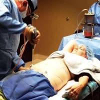 How to get rid of stubborn belly fat liposuction