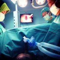 Tummy tuck general anesthesia