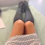 compression stockings for women