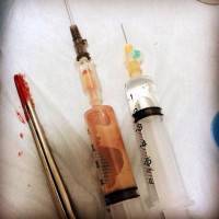 Exparel tummy tuck syringe
