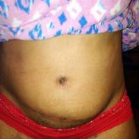 Infected belly button after a tummy tuck