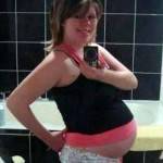 Pregnancy after tummy tuck medical questions photos