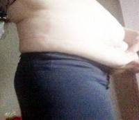 The Abdominoplasty surgery before
