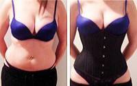 The girdle after tummy tuck