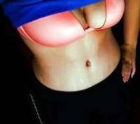 Tummy tuck scar care after surgery