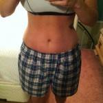 Full or mini tummy tuck before and after photos