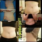 Lipo and tummy tuck before and after photos 14 weeks post op
