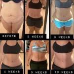 Lipo and tummy tuck recovery before and after photos
