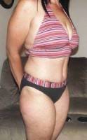 Lose weight before surgery photo