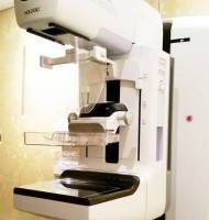 Mammogram before breast augmentation image