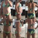 Tummy tuck before and after pics (5)
