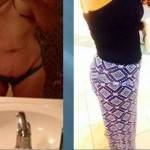 Tummy tuck before and after pics (8)