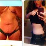 Tummy tuck before and after pics after pregnancy