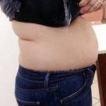 Tummy tuck before and after pics before surgery