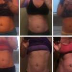 Tummy tuck before and after pics online
