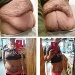 Tummy tuck pictures before and after (11)