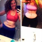 Tummy tuck pictures before and after (16)