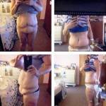 Tummy tuck pictures before and after (4)