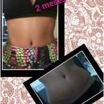Tummy tuck pictures before and after belly button