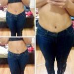 Before and after tummy tuck (11)