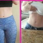 Before and after tummy tuck pictures low scar
