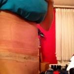 Tummy tuck results pictures (14)