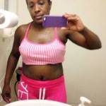Tummy tuck results pictures (15)