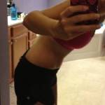 Tummy tuck results pictures (33)