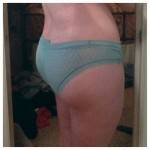 Tummy tuck results pictures (41)