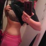 Tummy tuck results pictures (53)