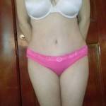 Tummy tuck results pictures photos