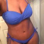 Tummy tuck results pictures stretch marks