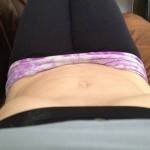 Tummy tuck photos before and after Baltimore top plastic surgeons
