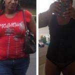 Tummy tuck photos before and after of plastic surgery shapshot